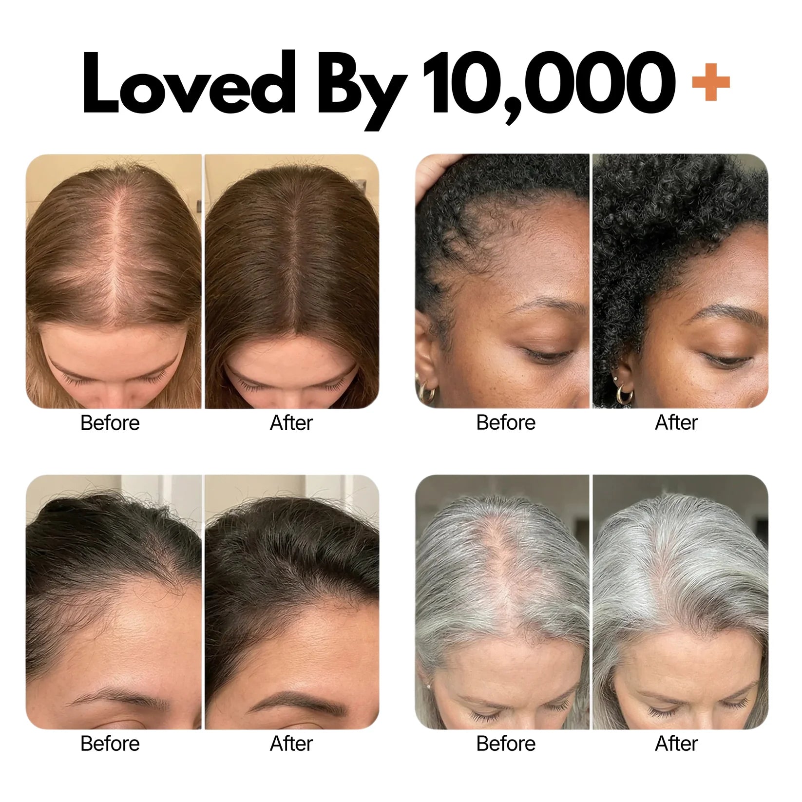 Glowy #1 Hair Growth Serum