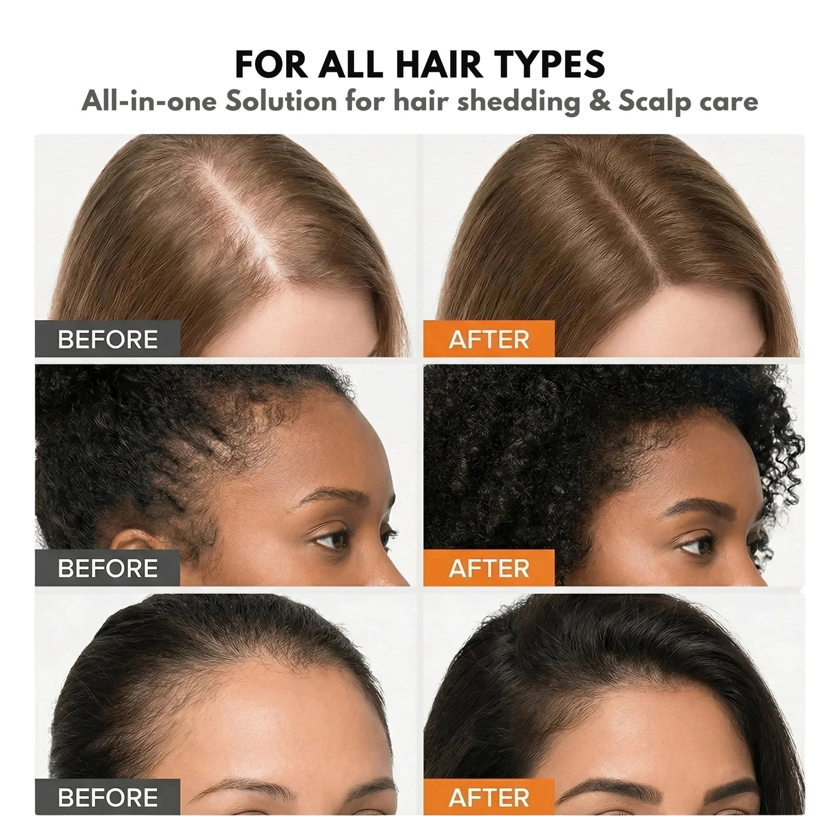 Glowy #1 Hair Growth Serum